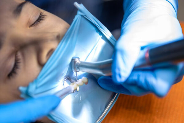¿Qué es una endodoncia? Infórmate en Clinica dental Mar Tarazana, Valencia centro.