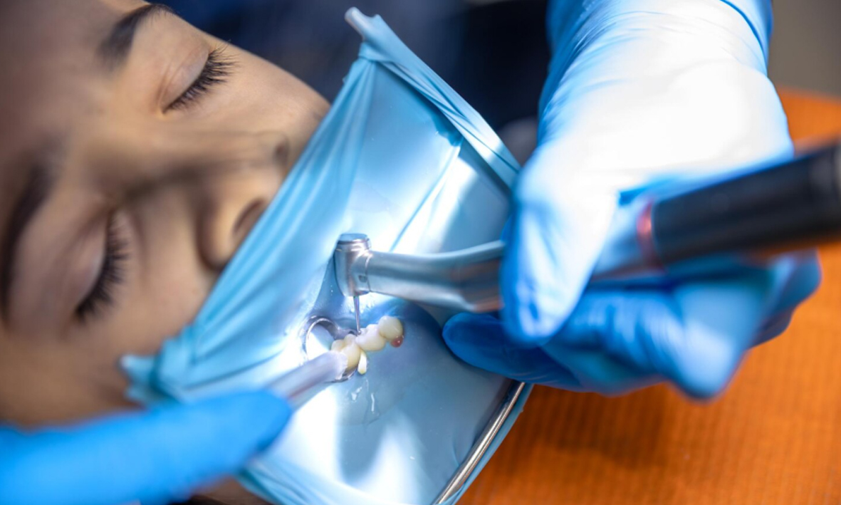 Qué es la endodoncia y cómo puede salvar tus dientes