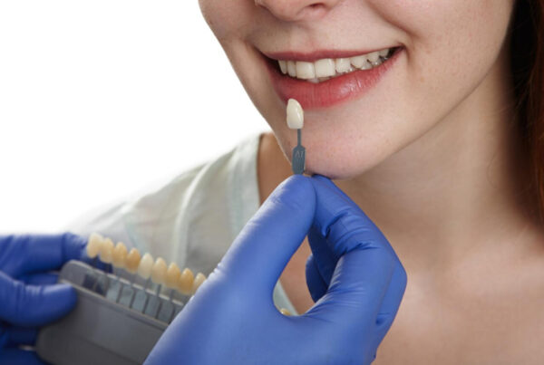 Implante dental, clinica dental en el centro de Valencia.