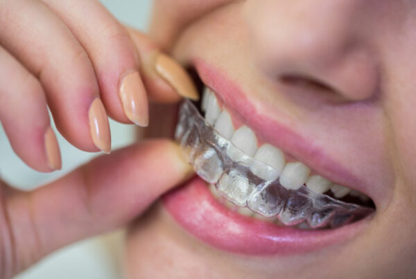 Ortodoncia. Infórmate en Clinica dental Mar Tarazona, Valencia centro.