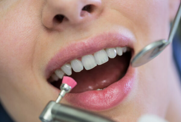 Beneficios de la limpieza dental